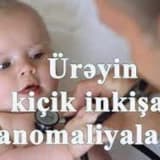 Üreyin kicik inkisaf anomaliyalari