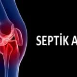 Septik artritlərin konservativ və cərrahi müalicəsi