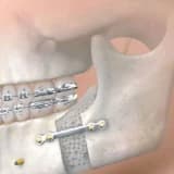 Üz-çənə cərrahiyyəsi