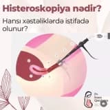 Histeroskopiya Nədir?
