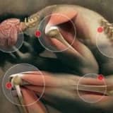 Somatizasiya nədir? Somatoform pozuntular