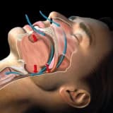 Xoruldama Cərrahiyyəsi: Yuxuda Nəfəs Alma Problemlərinin Həllinə Effektiv Bir Yanaşma