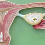Endometriyanın diaqnostik qaşınması