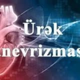 Sol mədəciyin anevrizması: Ürək divarında təhlükəli genişlənmə