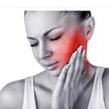 Trigeminal nevralgiya