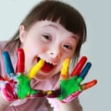 Daun sindromlu uşaqların psixoloji xüsusiyyətləri
