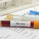 PSA analizi nədir?
