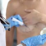 Döş Bərpası Cərrahiyyəsi