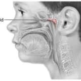 Adenoid vegetasiya