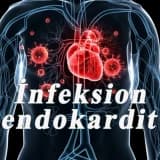 Endokardın xəstəlikləri