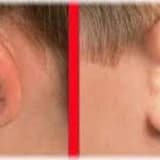 Qulaq əməliyyatları