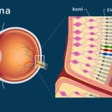 Retina Problemləri: Görməyə təsir edən göz xəstəlikləri