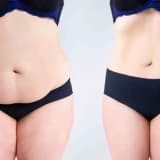 2 pack Lipo ( qadınlarda )