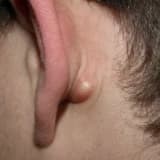 Mastoidit