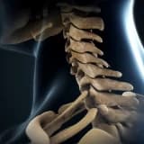 Baş boyun əməliyyatları