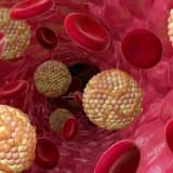 Xolesterol nedir?
