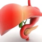 Qaraciyər Hemangioması