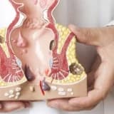 Anal Nahiyə Xəstəlikləri: Diaqnoz, Simptomlar və Müalicə