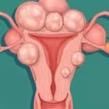 Uşaqlıq boynunun xəstəlikləri