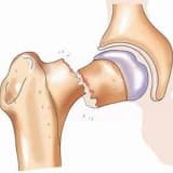 Bütün sınıqların və çıxıqların təmiri