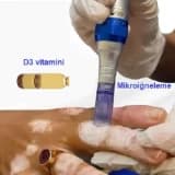 Vitiligo üçün Mikronidling və Vitamin D Müalicələri: Yanaşmalar və Potensial Faydalar
