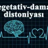 Vegetativ-damar distoniyası