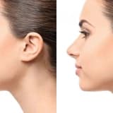 Burun əməliyyatının zərərləri və əməliyyat sonrası şişlər