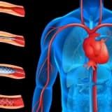 Valvular Ürək Xəstəliyi