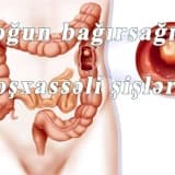 yogun bagirsagin xosxasseli sisleri