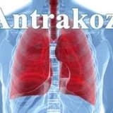 Antrakoz