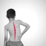 Anadangəlmə Onurğa Sütun Xəstəlikləri: Diaqnoz, Müalicə və İdarəetmə