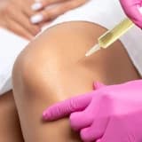 PRP (trombositlə zəngin plazma) nədir?