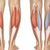 Bud Estetikası (Implant ve Piy): Güclü və Estetik Ayaqlar üçün İnnovativ Həll