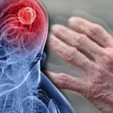 Parkinson Xəstəliyi: Səbəblər, Tanı, və Həyat Üçün İdarə Yolları