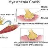 Miasteniya qravis səbəbi ilə timus cərrahiyyəsi