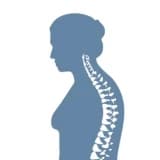 Osteoporoz: səbəbləri, simptomları və müalicəsi