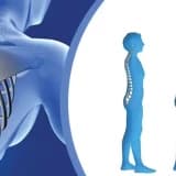Osteoporozun risk faktorları