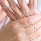 Əllərin əsməsi nəyə işarə edir?