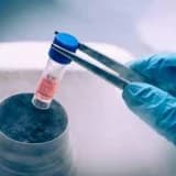 Kök hüceyrə terapiyası