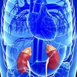 Feoxromositoma haqqında melumat