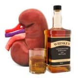 Alkoqol nefropatiyası