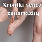 Xroniki venoz çatışmazlıq və ya varikoz damarları nədir?