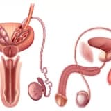 Prostatit