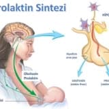 Prolaktin (süd hormonu) hormon yüksəkliyi (PROLAKTİNOMA)