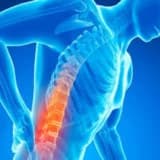 Bel Yırtığı (Qrija) Nədir? | Bel Yırtığının Müalicəsi Necə Olmalıdır?