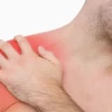 Təkrarlanan Çiyin Çıxığı (Bankart Lezyonu) Cərrahiyyəsi