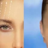 Göz qapaqlarının estetikası haqqında məlumat