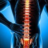 Osteoporoz (sümük əriməsi)