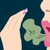 Ağız Qoxusu (Halitosis): Səbəbləri, Təsirləri və Müalicə Yolları