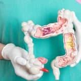 İrritabl bağırsaq sindromu (IBS)